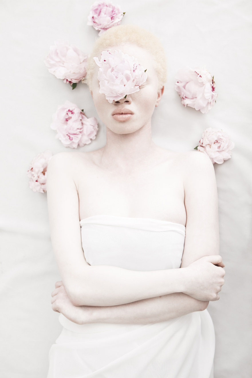 Удивительные люди — альбиносы