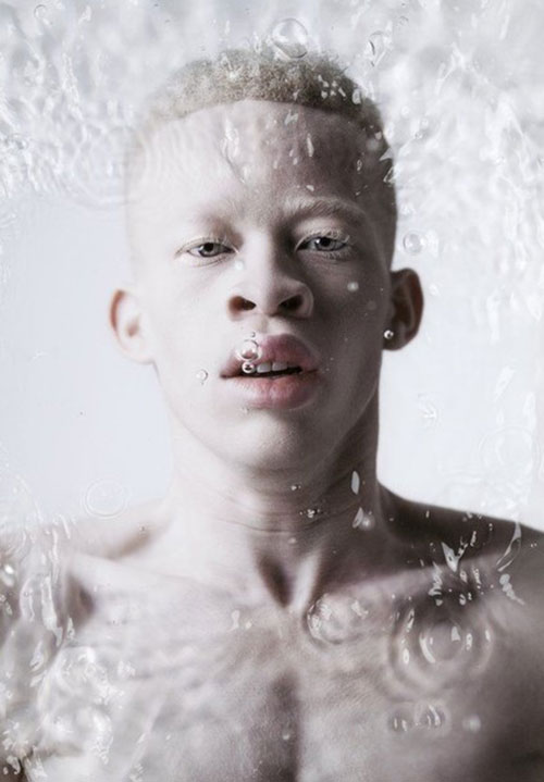 albinos (3)