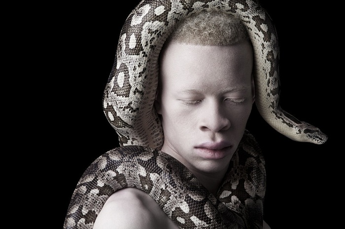 albinos (5)
