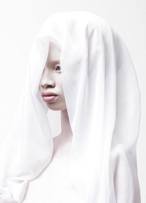 albinos (7)