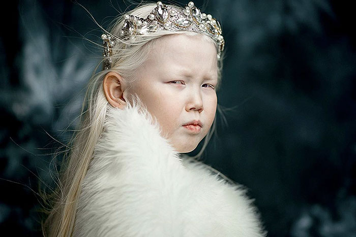 Уникальная красота 8-летней девочки-альбиноса покорила пользователей Сети